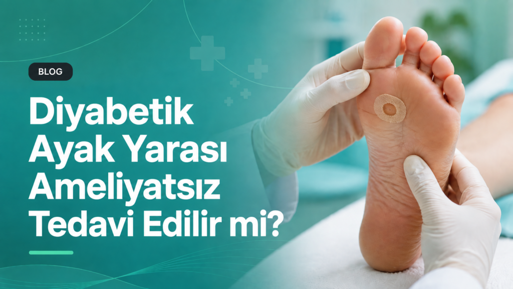 Diyabetik Ayak Yarası Ameliyatsız Tedavi Edilir mi?